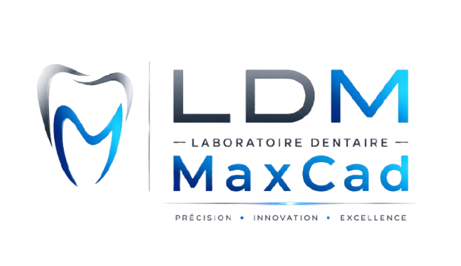 LDM